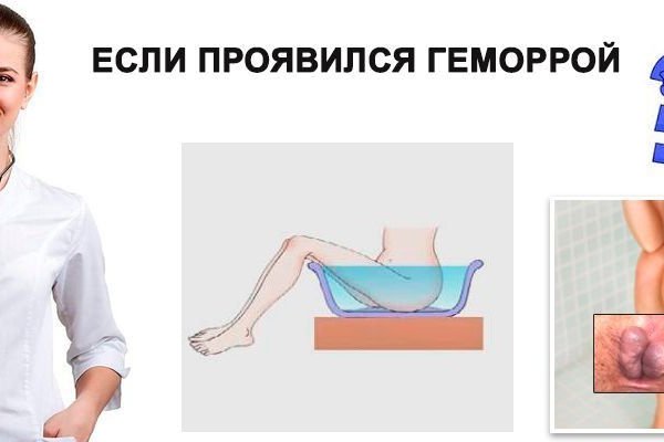 Кракен маркетплейс что это